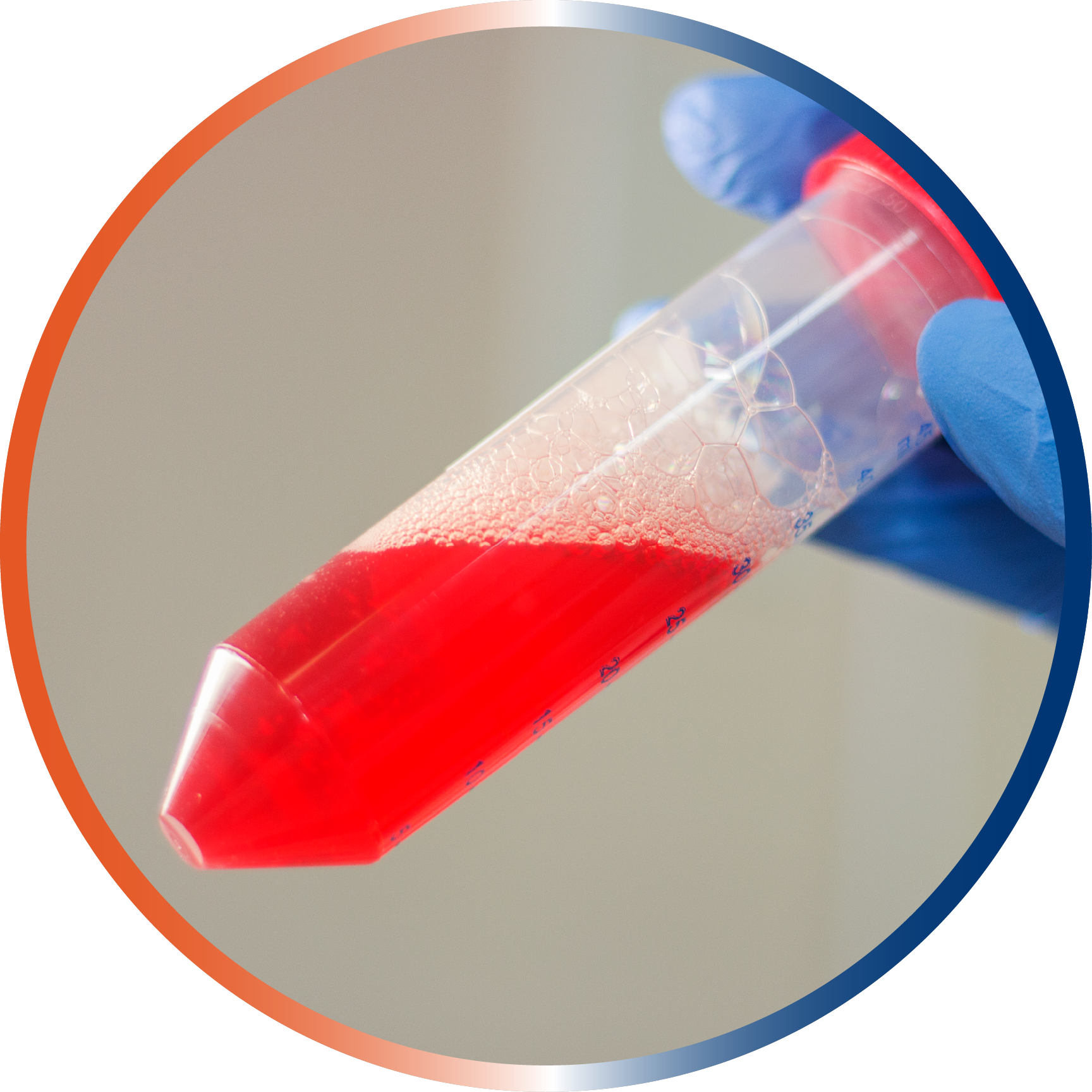 A and with a blue lab glove holding a centrifugation tube containing a red liquid which is the lysate of white blood cells.